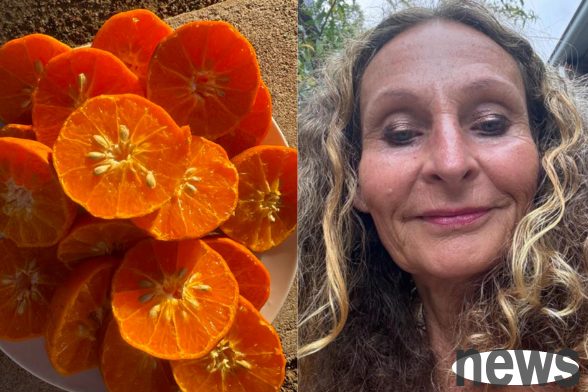 A 58-year-old woman 